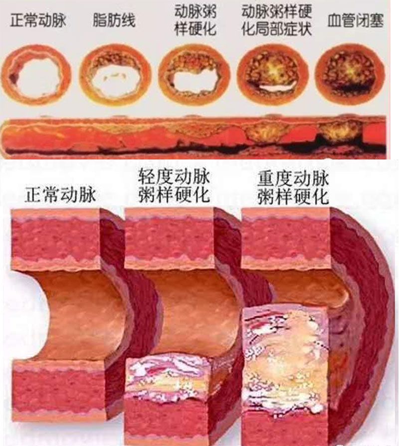 血管图片.jpg