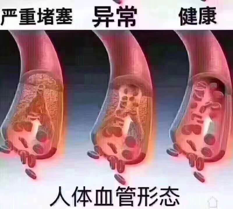 血管图片-2.jpg